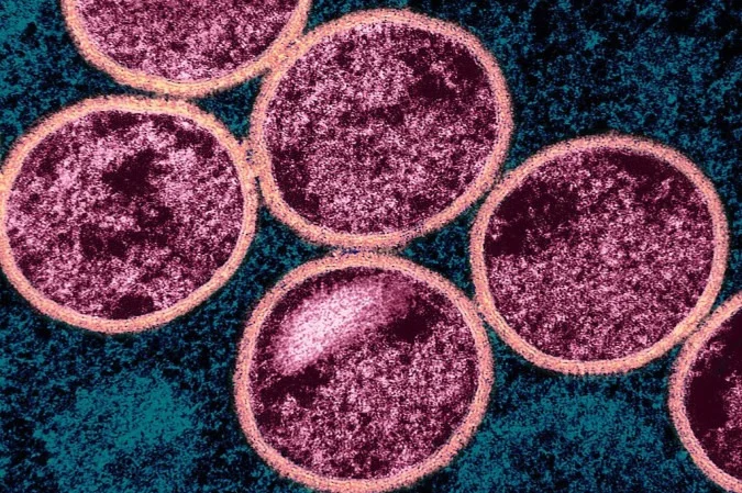 1_mpox_virus___53848137961-53737199